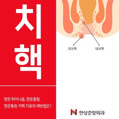 항문 튀어나옴 원인