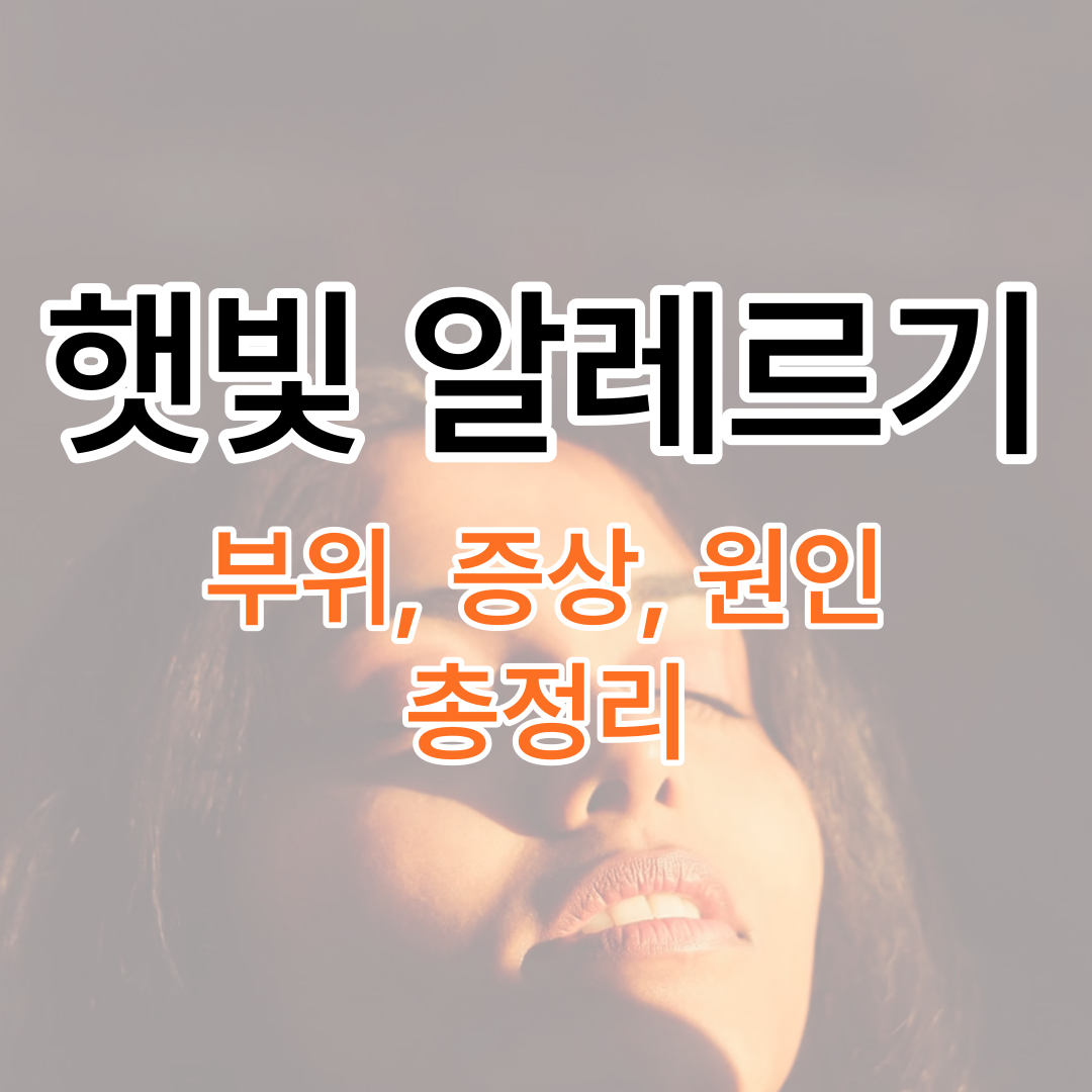 햇빛 알레르기 증상 및 후기
