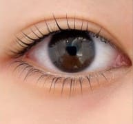 아이링-시술-눈