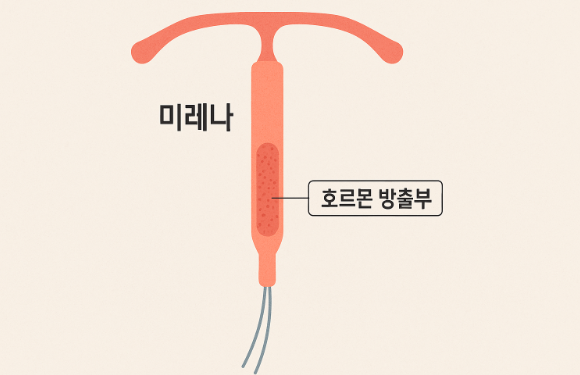 미레나-T자형-구조