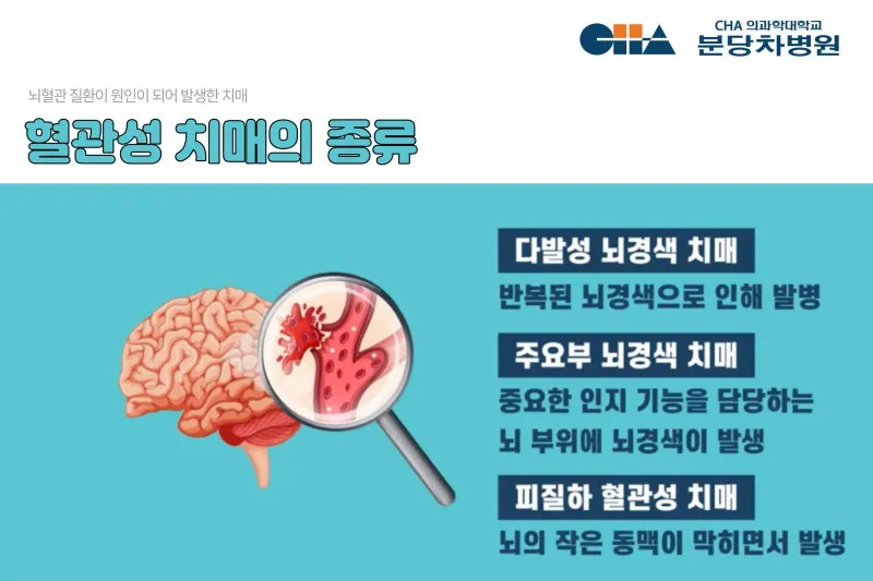 혈관성치매 원인 증상 치료법과 예방 생활습관_6