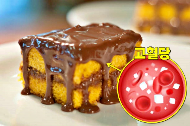 비듬이 생기는 원인 5가지 혈당이 높을때 증상, 건강 팁줌 매일꿀정보