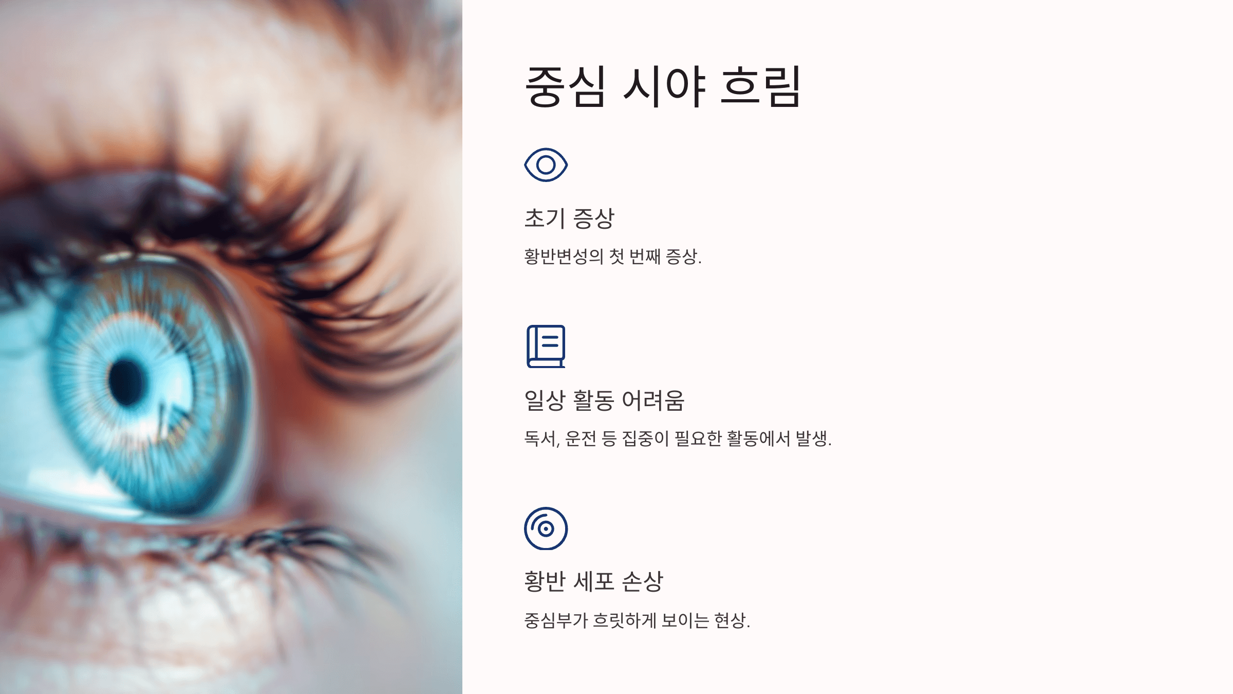 황반변성과 관련된 사진입니다.