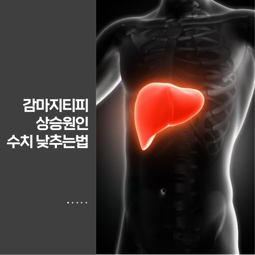 감마지티피 상승원인