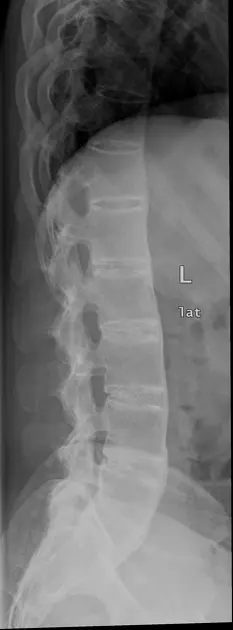 Bamboo spine