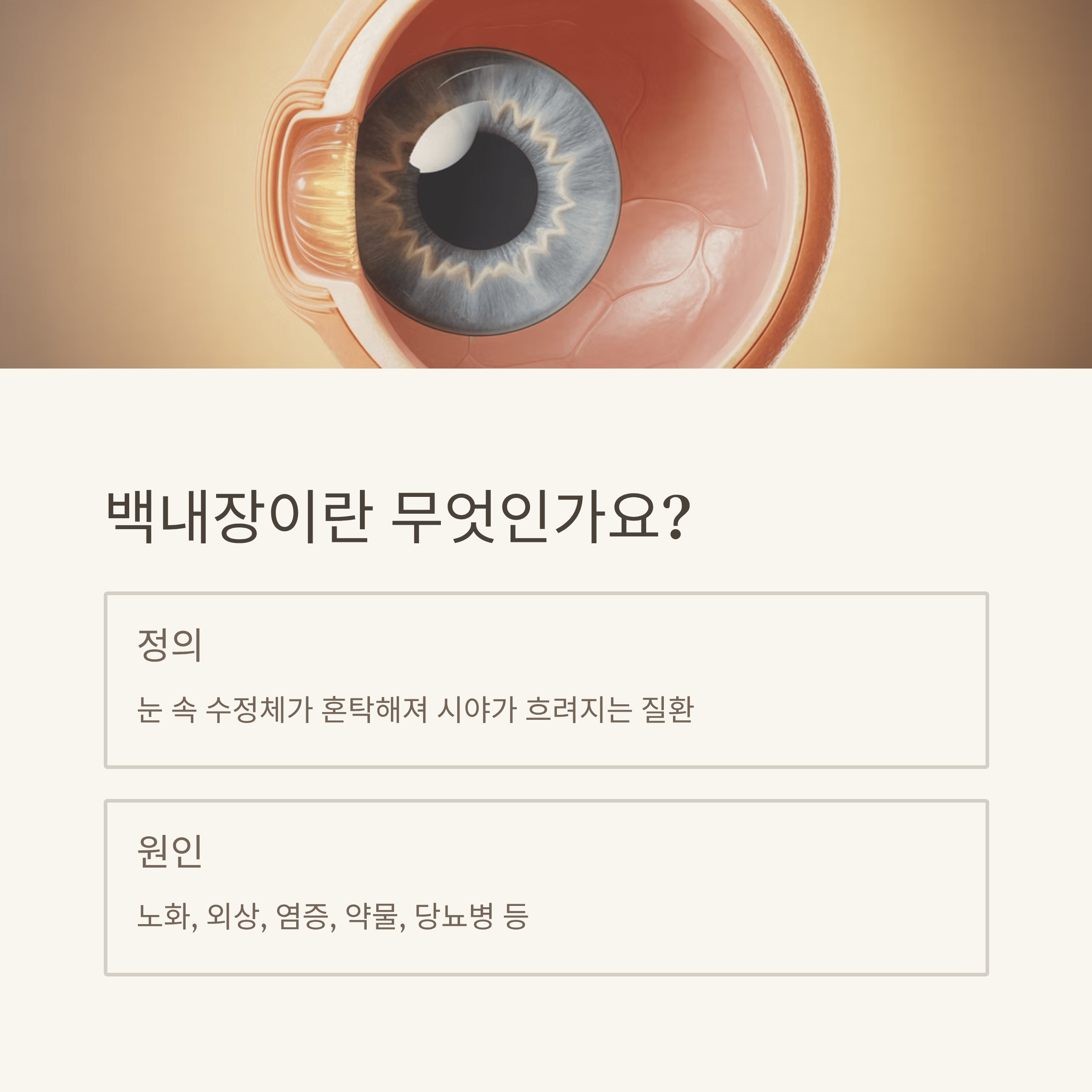 백내장(Cataracts) 증상과 치료 방법