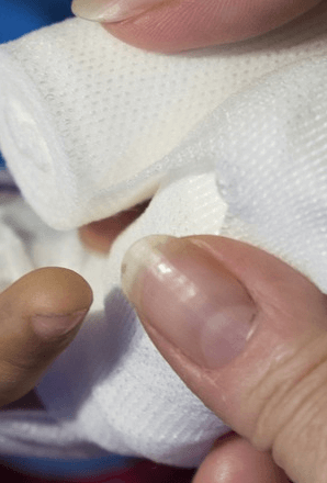 손가락마디통증