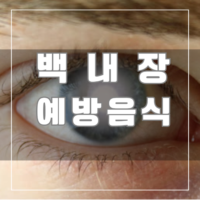 백내장 예방음식