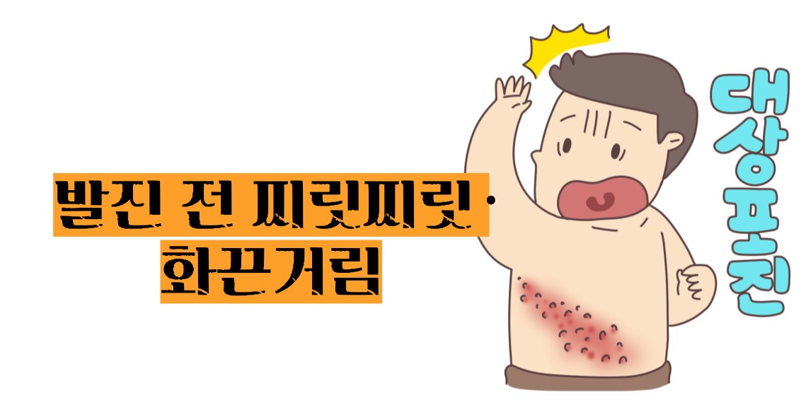 대상포진 초기증상