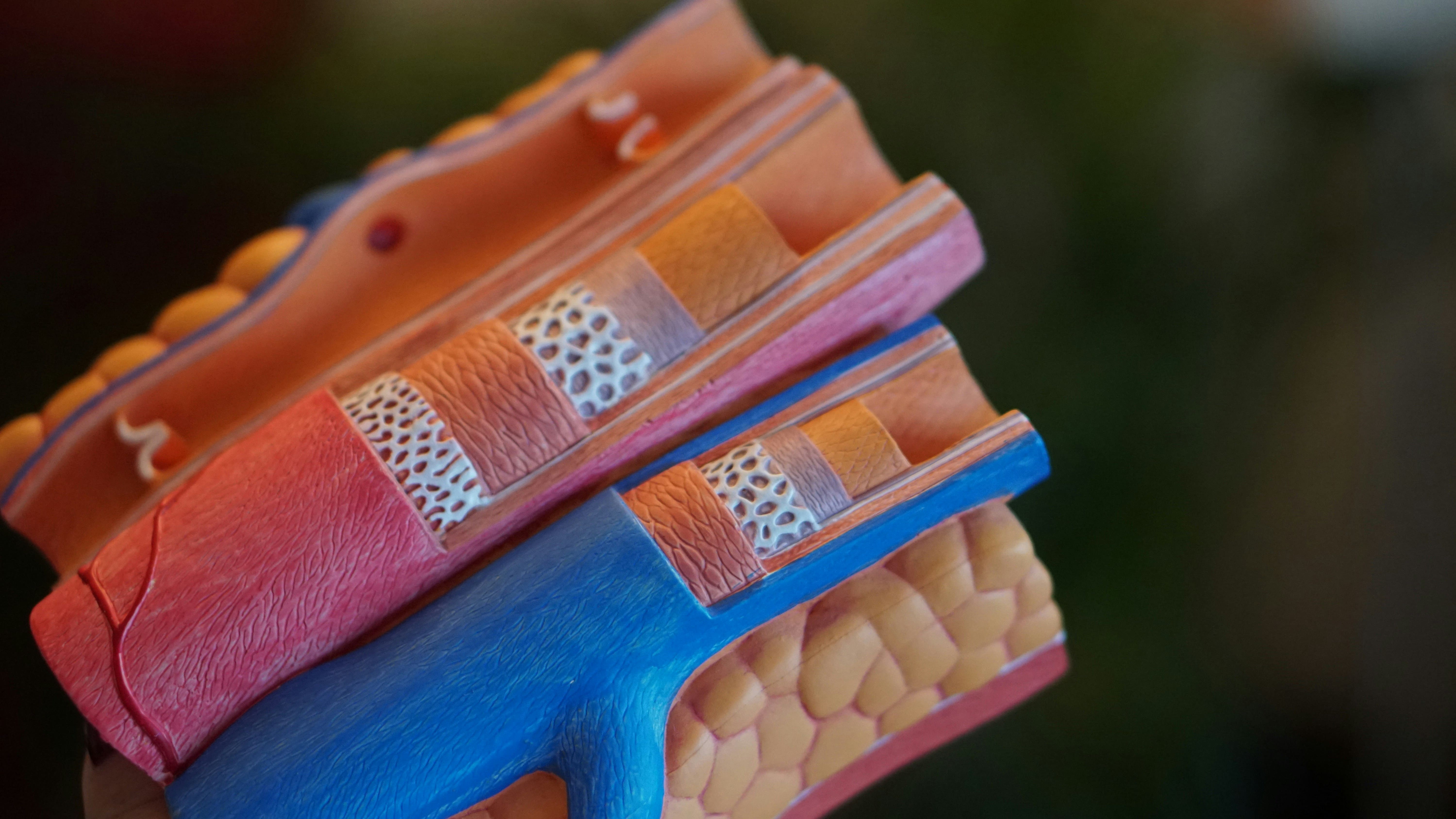 심실세동 심전도 증상 원인, 치료방법