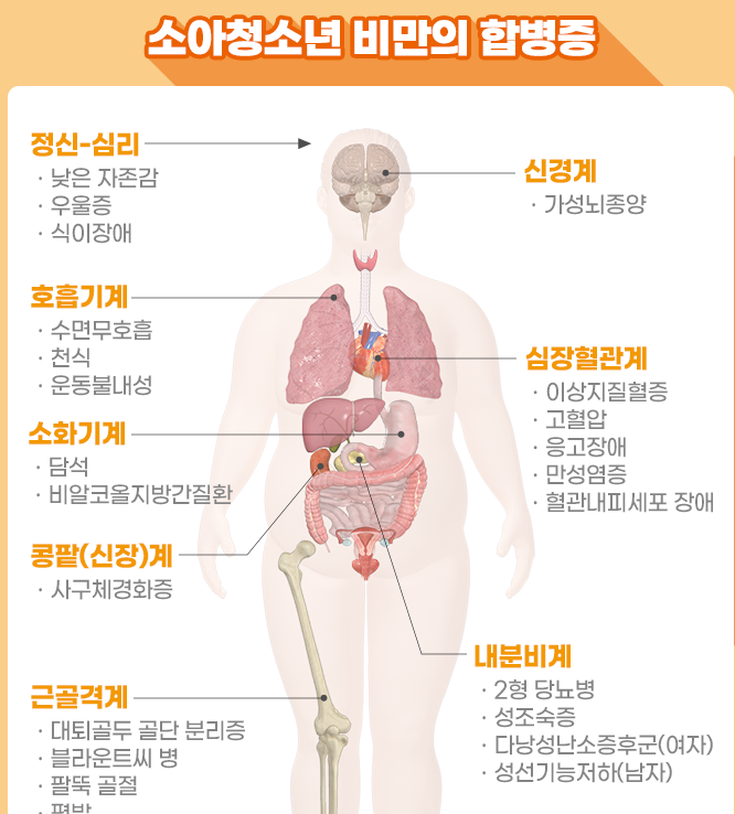 소아비만