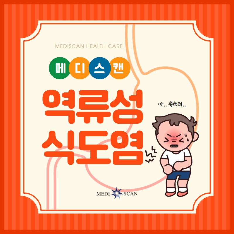 역류성 식도염 목 이물감&amp;#44; 가래가 낀 것처럼 느껴지는 이유