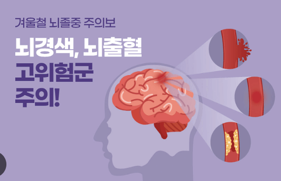 뇌경색원인