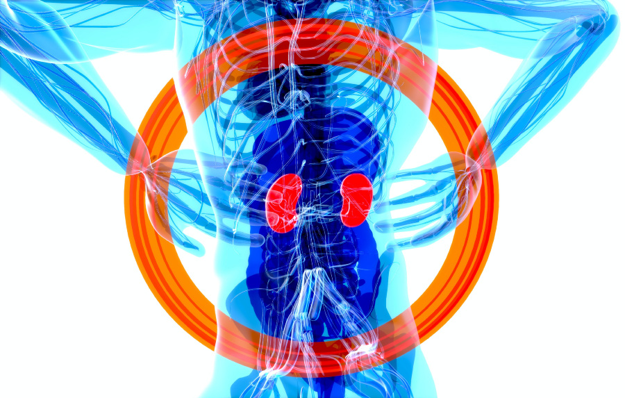 인체의 신장, 즉 콩팥의 위치와 형태를 빨갛게 그린, X-ray 형태의 그림 사진