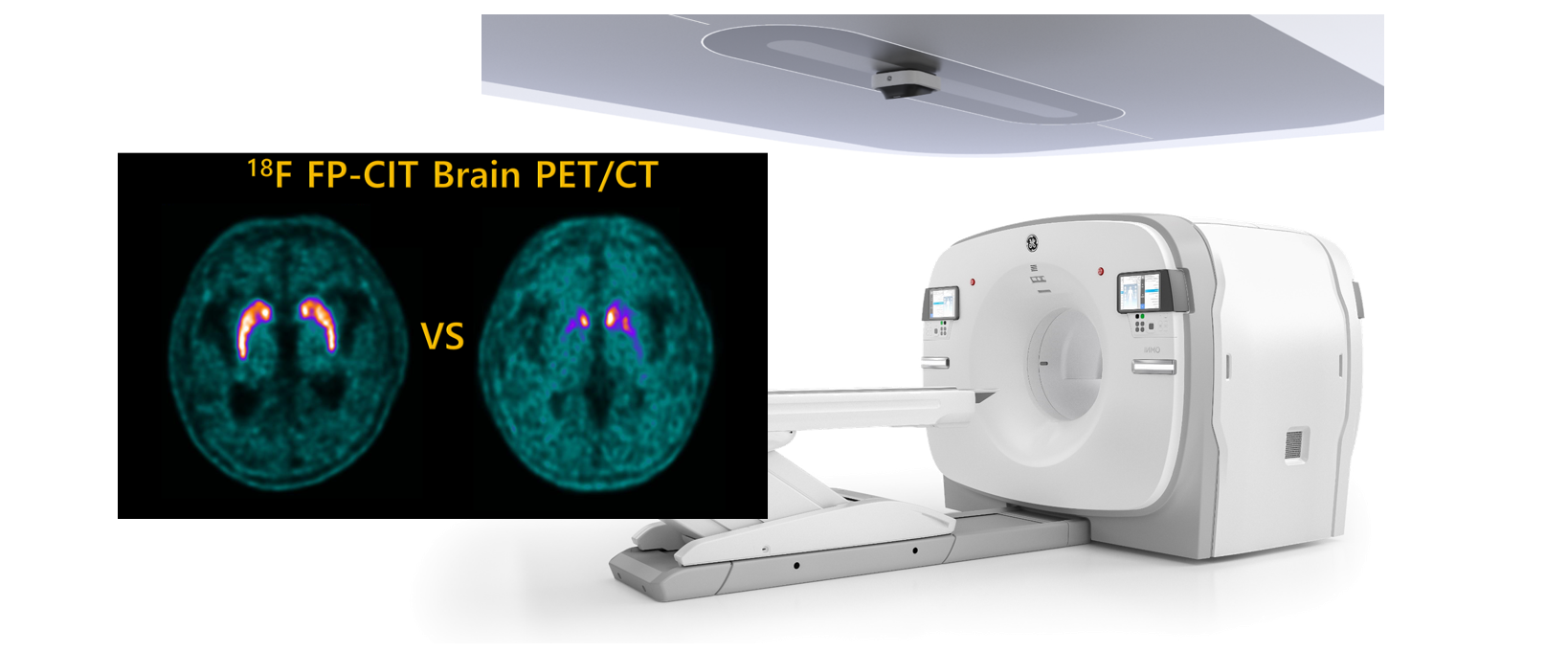 PET/CT를 이용하여 파킨슨병을 진단 할 수 있다.