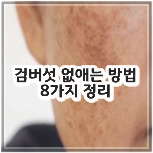 검버섯 없애는 방법 8가지 정리