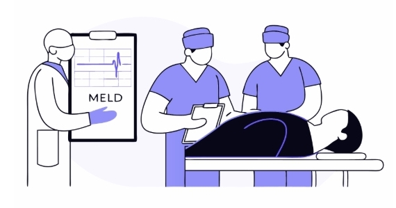 간경화 치료 과정