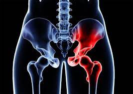 관절에 좋은 운동 (2주 해보고 효과 본 후기)