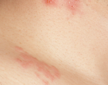 땅콩 수확시기 땅콩 효능