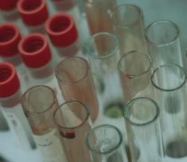 빈혈 치료방법 진단기준 합병증