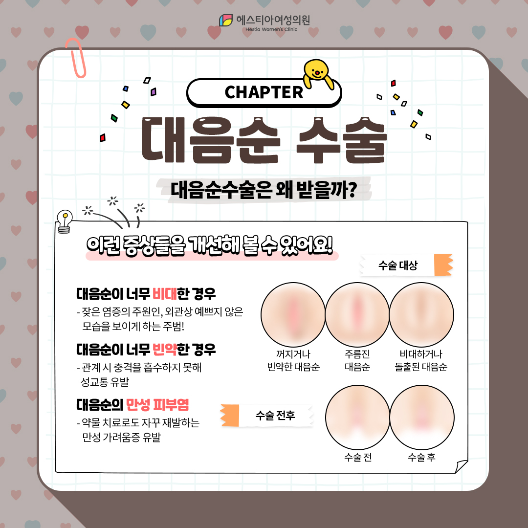 대음순수술은 왜 받을까?
