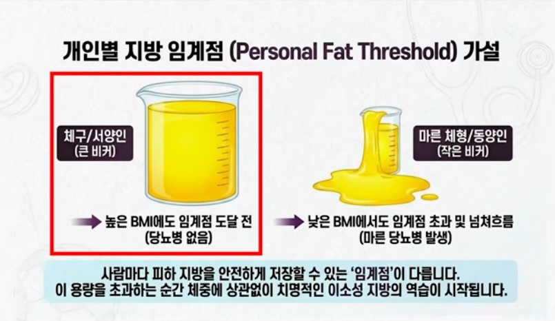 서양인과 동양인의 신체적 특성 차이로 인한 당뇨 발생의 차이점