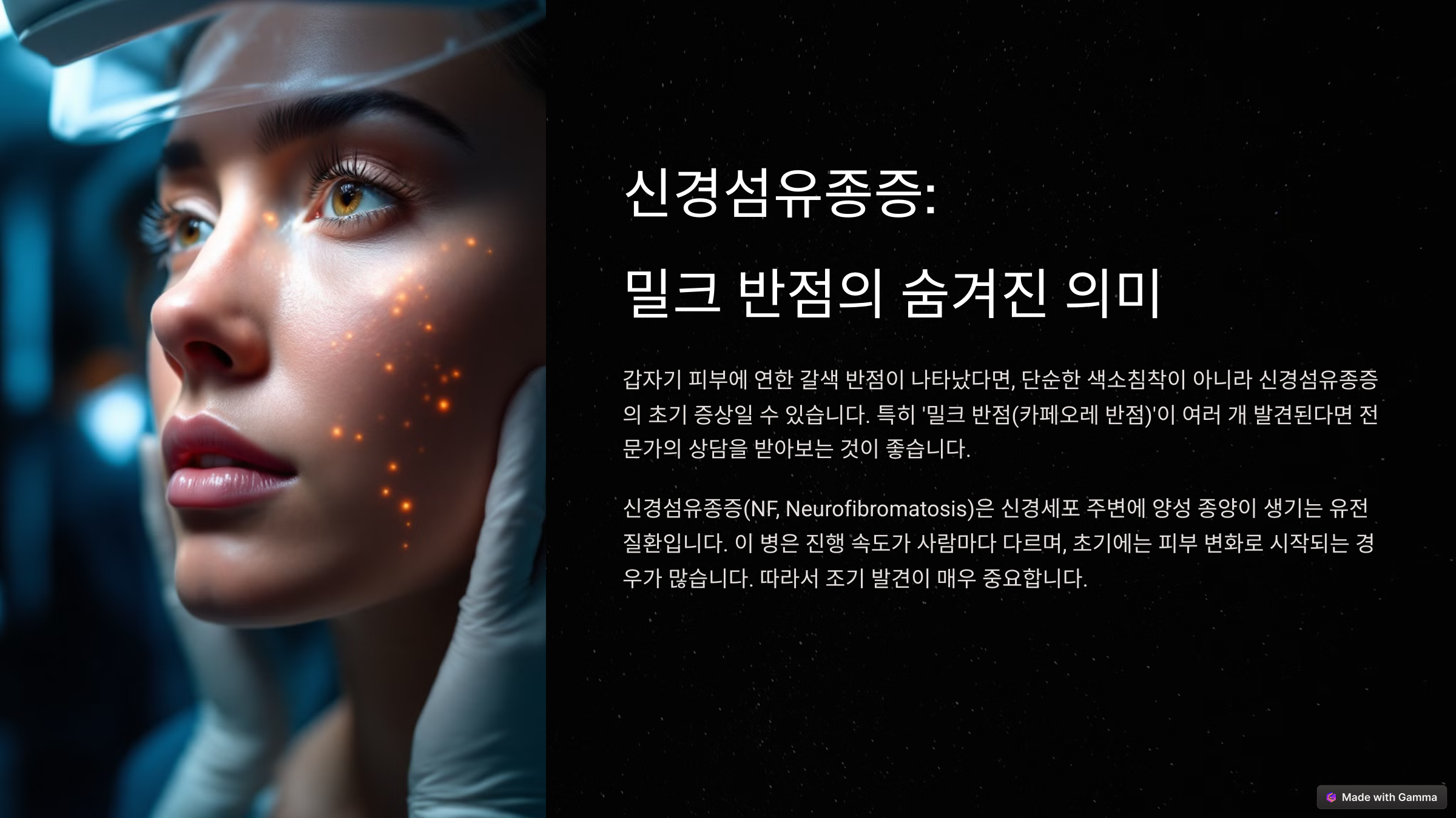 피부에 갑자기 밀크 반점? 신경섬유종 초기 증상 체크!
