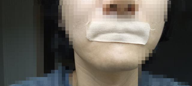 이지숨 테이프 착용후기