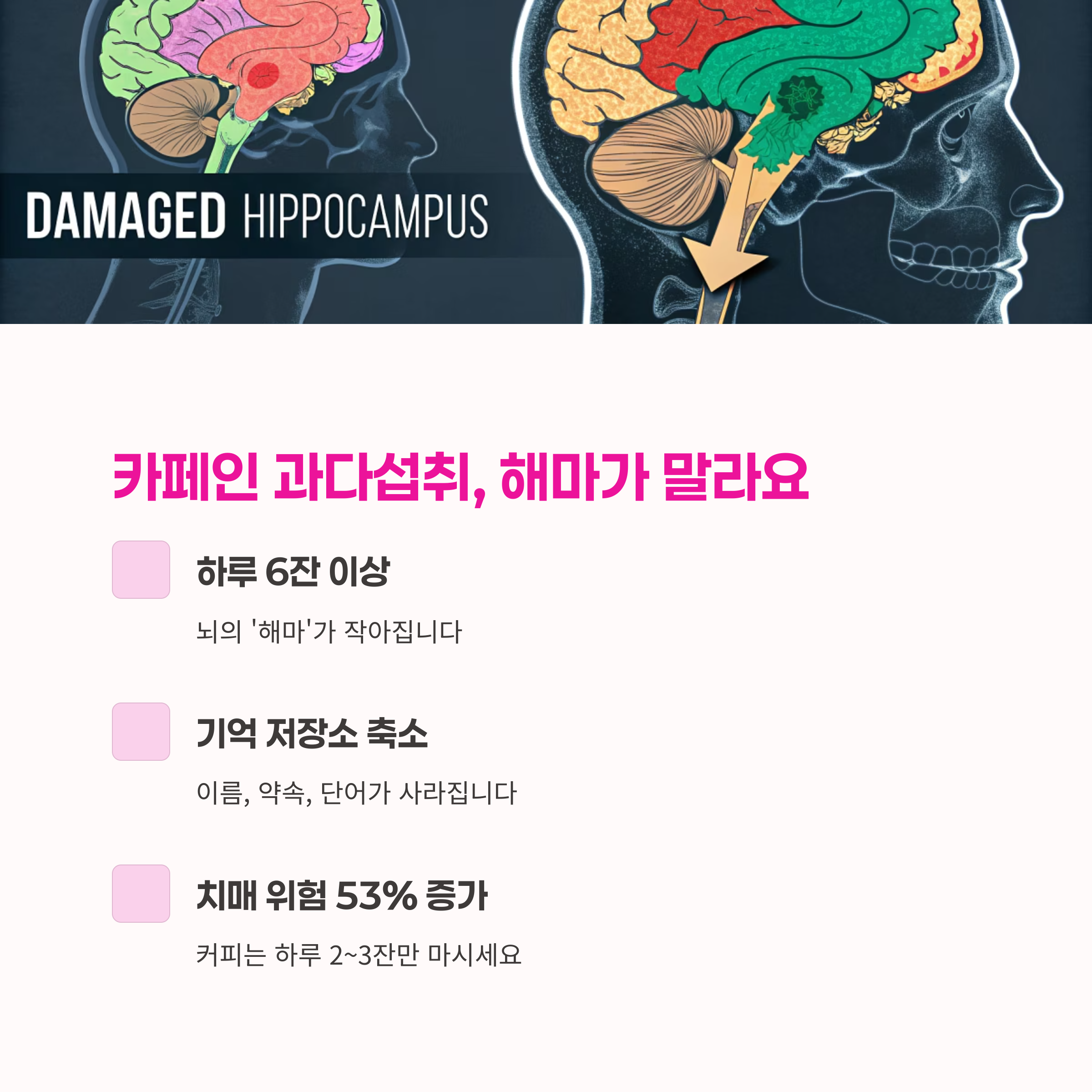 뇌 건강,