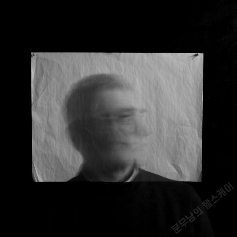 알콜성치매 초기증상