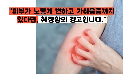 췌장암 초기증상
