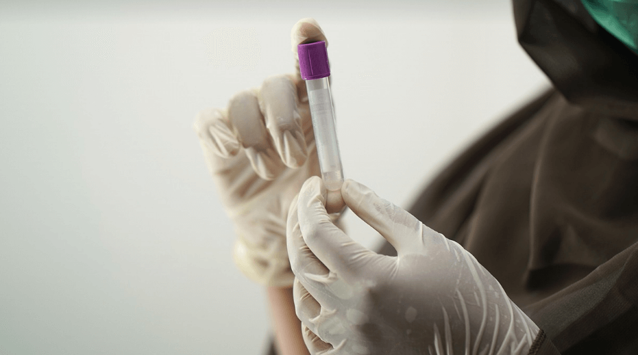 방귀 냄새가 심한 이유가 되는 관련 사진 - 10