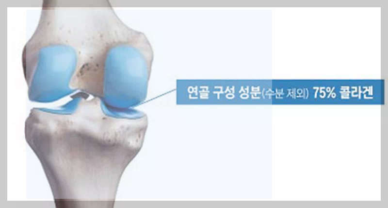 연골 구성 성분
