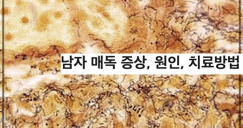 남자 매독 증상, 원인, 치료방법 총정리