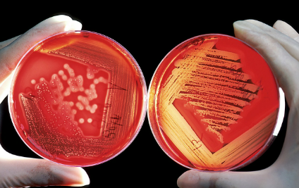 "모든 세균은 해롭다?"