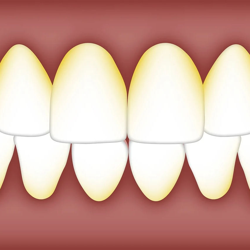 스케일링 비용3