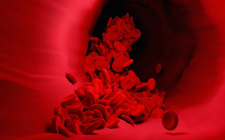 한랭글로불린혈증, 낮은 온도에서 혈액이 응고되는 희귀 질환(증상, 치료법)