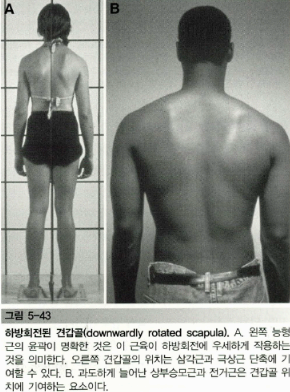 견갑대의 운동손상 증후군 - 견갑골 하방회전 증후군