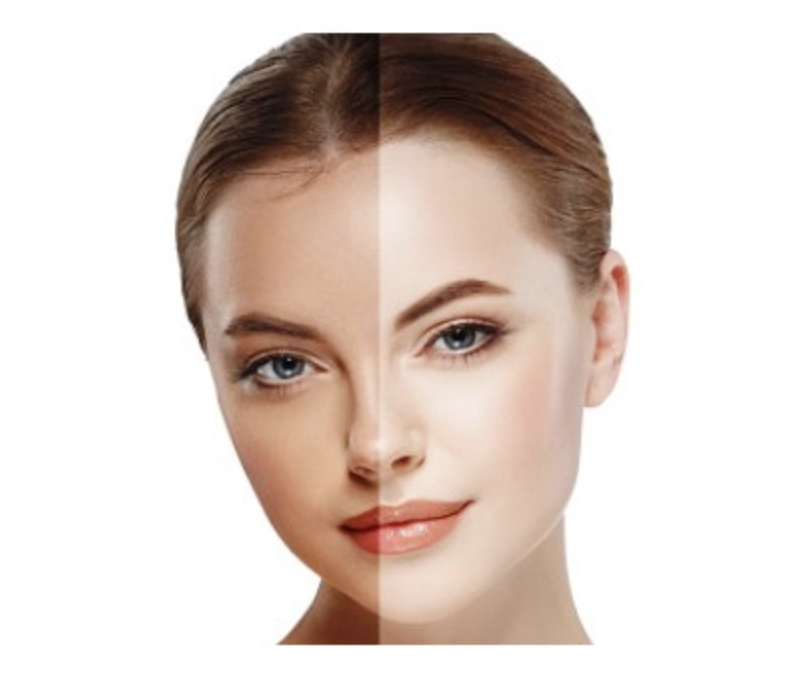 화이트 테닝 후 관리법