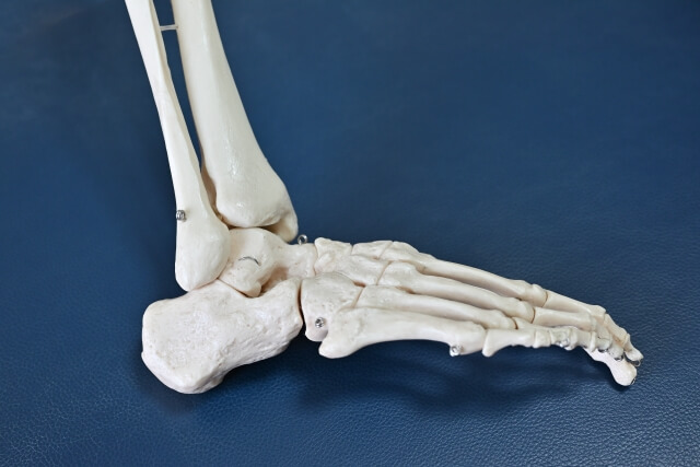 족저 근막염 증상 원인 치료법