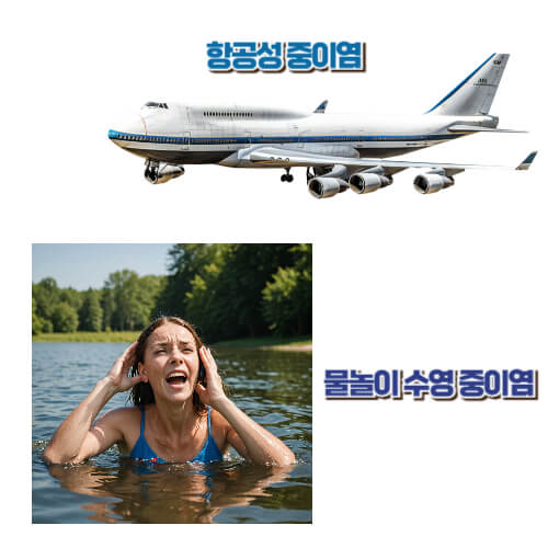 중이염 원인
