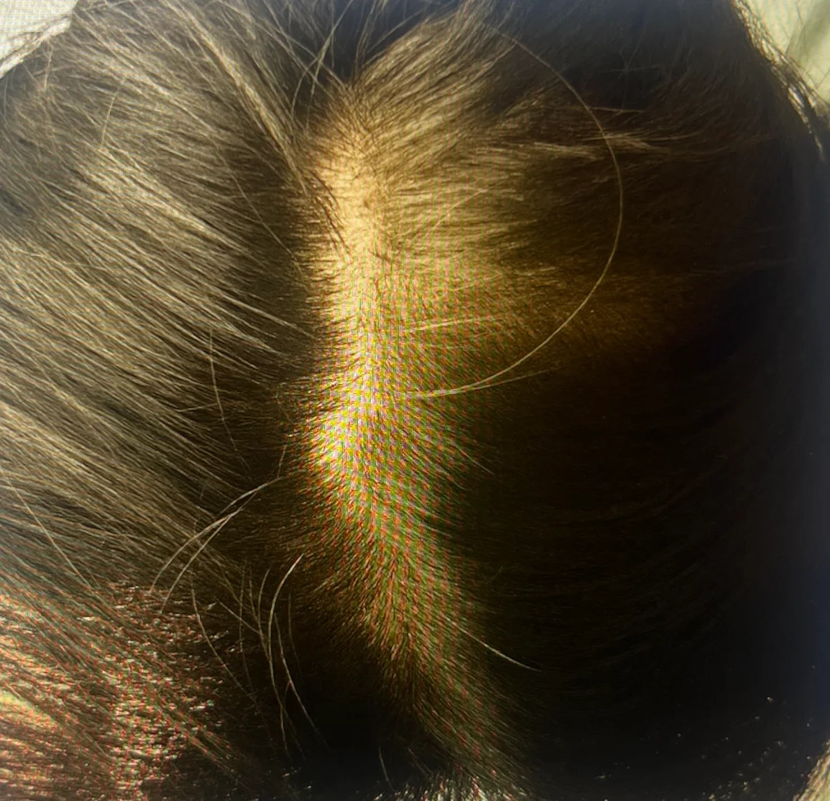 오프온-단백질-탈모-샴푸-사용-후-두피-상태