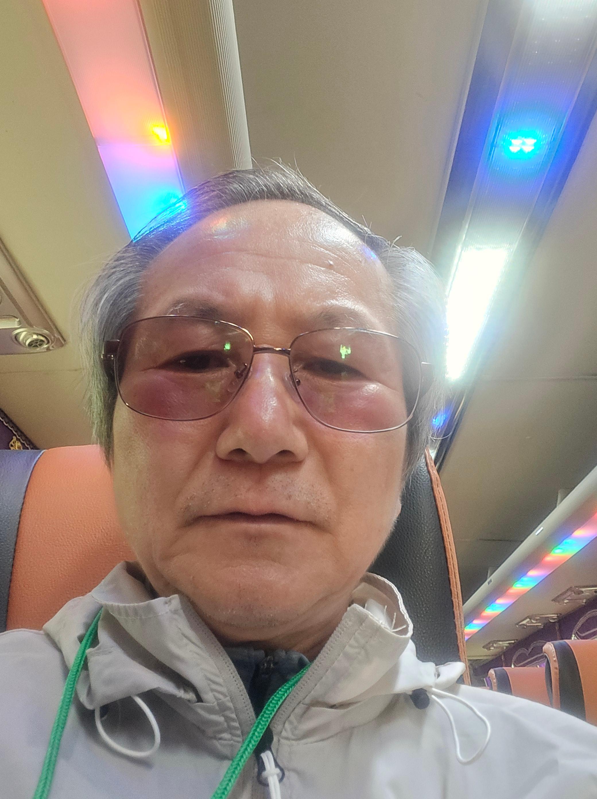 여름철에는 피부만 자외선을 조심하는 것이 아니라 눈도 함께 보호