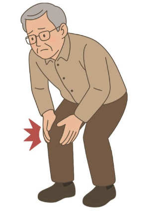 퇴행성 관절염 증상 22