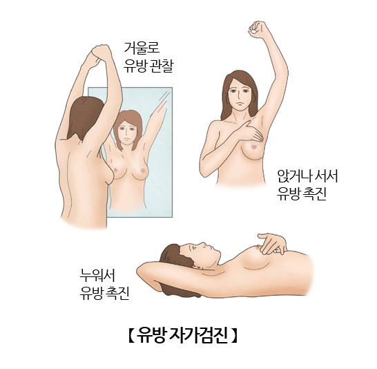 매월 집에서 혼자 하는 유방 자가 진단