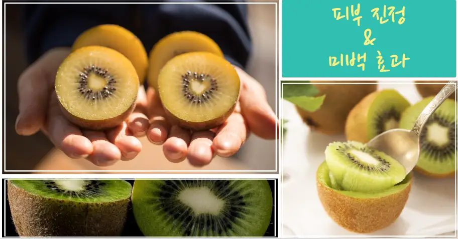 키위 – 비타민 C 폭탄으로 피부 진정 & 미백 효과