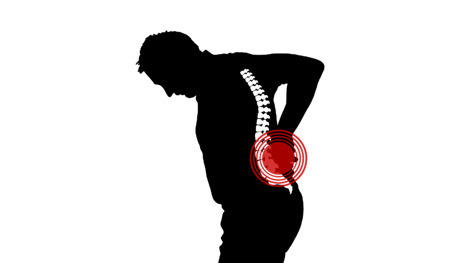 이상근 증후군(Piriformis Syndrome), 좌골신경통의 숨은 원인과 효과적인 관리