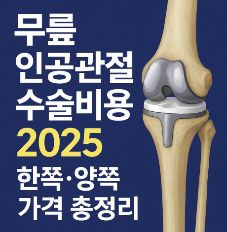 무릎 인공관절 수술비용 2025 한쪽,양쪽 가격 총정리