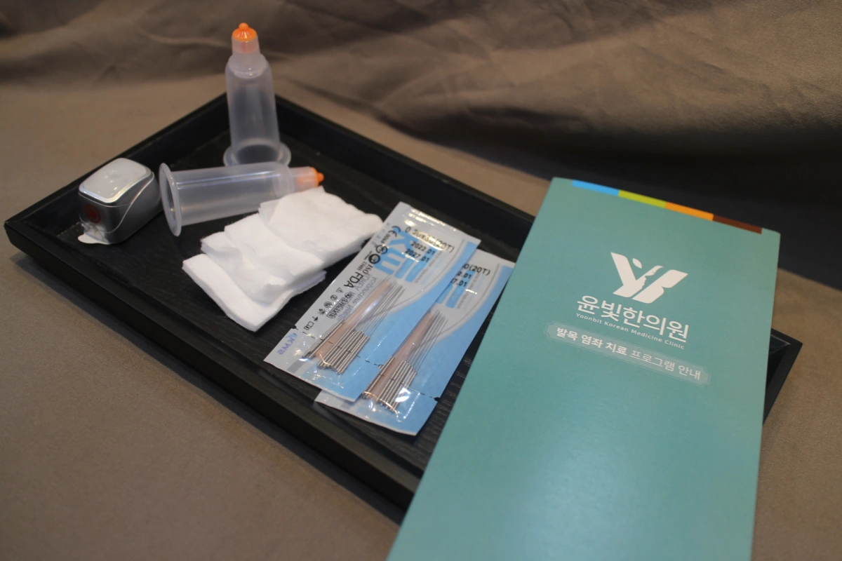 족관절 염좌의 원인, 증상, 진단, 한의원 치료 침 뜸 부항 약침
