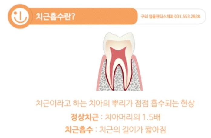 치아교정 부작용